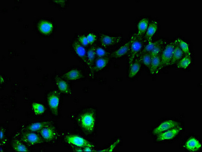Immunofluorescence(IF) - HLA-B Antibody