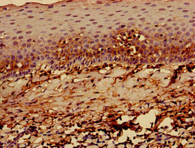Immunohistochemistry of paraffin-embedded human tonsil tissue using CSB-PA15099A0Rb at dilution of 1:100