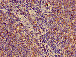 Immunohistochemistry of paraffin-embedded human lymph node tissue using CSB-PA15099A0Rb at dilution of 1:100