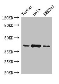 Western Blot Positive WB detected in: Jurkat whole cell lysate, Hela whole cell lysate, HEK293 whole cell lysate All lanes: HLA-C antibody at 4microg/ml Secondary Goat polyclonal to rabbit IgG at 1/50000 dilution Predicted band size: 41 kDa Observed band size: 41 kDa