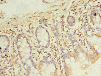 Immunohistochemistry of paraffin-embedded human small intestine tissue using CSB-PA526126LA01HU at dilution of 1:100