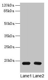 Western blot All lanes: PDE6D antibody at 1.5microg/ml Lane 1: A549 whole cell lysate Lane 2: MCF-7 whole cell lysate Secondary Goat polyclonal to rabbit IgG at 1/10000 dilution Predicted band size: 18 kDa Observed band size: 18 kDa Western blot All lanes: PDE6D antibody at 1.5microg/ml Lane 1: A549 whole cell lysate Lane 2: MCF-7 whole cell lysate Secondary Goat polyclonal to rabbit IgG at 1/10000 dilution Predicted band size: 18 kDa Observed band size: 18 kDa