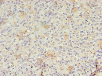 Immunohistochemistry of paraffin-embedded human pancreatic tissue using CSB-PA613602LA01HU at dilution of 1:100