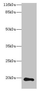 Western blot All lanes: RAB30 antibody at 1microg/ml + Hela whole cell lysate Secondary Goat polyclonal to rabbit IgG at 1/10000 dilution Predicted band size: 24, 19 kDa Observed band size: 19 kDa Western blot All lanes: RAB30 antibody at 1microg/ml + Hela whole cell lysate Secondary Goat polyclonal to rabbit IgG at 1/10000 dilution Predicted band size: 24, 19 kDa Observed band size: 19 kDa