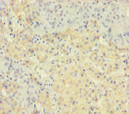 Immunohistochemistry of paraffin-embedded human adrenal gland tissue using CSB-PA624102LA01HU at dilution of 1:100