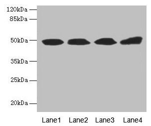 Western blot All lanes: TBCEL antibody at 12microg/ml Lane 1: Rat gonadal tissue Lane 2: PC-3 whole cell lysate Lane 3: Rat heart tissue Lane 4: 293T whole cell lysate Secondary Goat polyclonal to rabbit IgG at 1/10000 dilution Predicted band size: 49 kDa Observed band size: 49 kDa