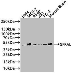 Western Blot Positive WB detected in:Mouse Liver tissue lysate All lanes: GFRAL antibody at 1:1000 Secondary Goat polyclonal to rabbit IgG at 1/50000 dilution Predicted band size: 45 kDa Observed band size: 55 kDa Western Blot Positive WB detected in:Mouse Liver tissue lysate All lanes: GFRAL antibody at 1:1000 Secondary Goat polyclonal to rabbit IgG at 1/50000 dilution Predicted band size: 45 kDa Observed band size: 55 kDa