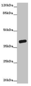 Western blot All lanes: OGFOD2 antibody at 3microg/ml + Mouse liver tissue Secondary Goat polyclonal to rabbit IgG at 1/10000 dilution Predicted band size: 39, 33, 15, 21 kDa Observed band size: 39 kDa