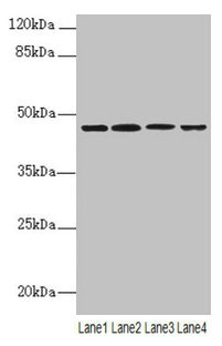 Western blot All lanes: NAPEPLD antibody at 6microg/ml Lane 1: Mouse large intestine tissue Lane 2: Mouse kidney tissue Lane 3: Mouse stomach tissue Lane 4: MCF-7 whole cell lysate Secondary Goat polyclonal to rabbit IgG at 1/10000 dilution Predicted band size: 46 kDa Observed band size: 46 kDa