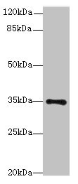 Western blot All lanes: MED27 antibody at 0.5microg/ml + A431 whole cell lysate Secondary Goat polyclonal to rabbit IgG at 1/10000 dilution Predicted band size: 36, 32, 15 kDa Observed band size: 36 kDa