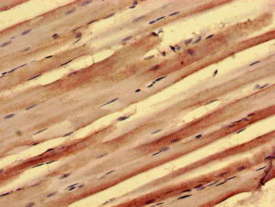 Immunohistochemistry of paraffin-embedded human skeletal muscle tissue using CSB-PA769802LA01HU at dilution of 1:100