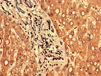 Immunohistochemistry of paraffin-embedded human liver tissue using CSB-PA769802LA01HU at dilution of 1:100