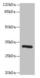 Western blot All lanes: PPP1R3B antibody at 6microg/ml + Mouse liver tissue Secondary Goat polyclonal to rabbit IgG at 1/10000 dilution Predicted band size: 33 kDa Observed band size: 33 kDa Western blot All lanes: PPP1R3B antibody at 6microg/ml + Mouse liver tissue Secondary Goat polyclonal to rabbit IgG at 1/10000 dilution Predicted band size: 33 kDa Observed band size: 33 kDa