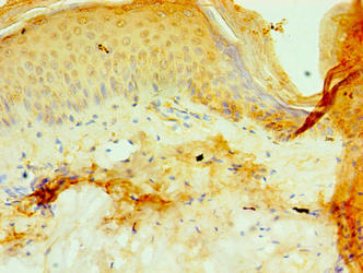 Immunohistochemistry of paraffin-embedded human skin tissue using CSB-PA772021LA01HU at dilution of 1:100