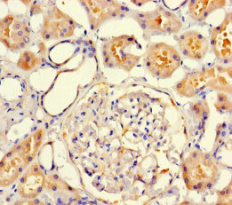 Immunohistochemistry of paraffin-embedded human kidney tissue using CSB-PA800218LA01HU at dilution of 1:100 Immunohistochemistry of paraffin-embedded human kidney tissue using CSB-PA800218LA01HU at dilution of 1:100