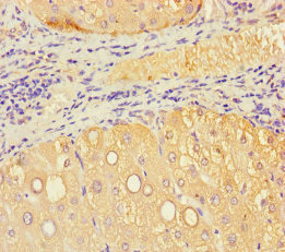 Immunohistochemistry of paraffin-embedded human liver tissue using CSB-PA800218LA01HU at dilution of 1:100