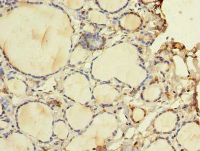 Immunohistochemistry of paraffin-embedded human thyroid tissue using CSB-PA810271LA01HU at dilution of 1:100