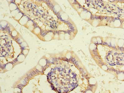 Immunohistochemistry of paraffin-embedded human small intestine tissue using CSB-PA810271LA01HU at dilution of 1:100