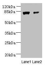 Western blot All lanes: WDR49 antibody at 7microg/ml Lane 1: A549 whole cell lysate Lane 2: Hela whole cell lysate Secondary Goat polyclonal to rabbit IgG at 1/10000 dilution Predicted band size: 80, 60 kDa Observed band size: 80 kDa