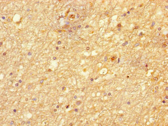 Immunohistochemistry of paraffin-embedded human brain tissue using CSB-PA810298LA01HU at dilution of 1:100