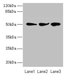Western blot All lanes: NIM1K antibody at 2microg/ml Lane 1: Jurkat whole cell lysate Lane 2: HepG2 whole cell lysate Lane 3: COLO205 whole cell lysate Secondary Goat polyclonal to rabbit IgG at 1/10000 dilution Predicted band size: 50 kDa Observed band size: 50 kDa Western blot All lanes: NIM1K antibody at 2microg/ml Lane 1: Jurkat whole cell lysate Lane 2: HepG2 whole cell lysate Lane 3: COLO205 whole cell lysate Secondary Goat polyclonal to rabbit IgG at 1/10000 dilution Predicted band size: 50 kDa Observed band size: 50 kDa
