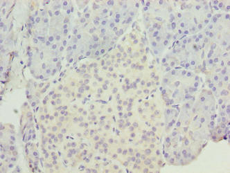 Immunohistochemistry of paraffin-embedded human pancreatic tissue using CSB-PA811602LA01HU at dilution of 1:100