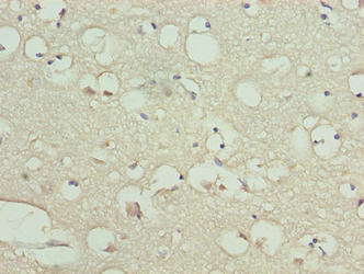 CSB-PA816919LA01HU
