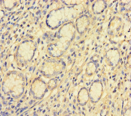 Immunohistochemistry of paraffin-embedded human stomach tissue using CSB-PA818673LA01HU at dilution of 1:100