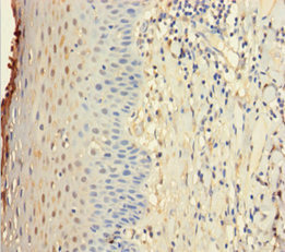 Immunohistochemistry of paraffin-embedded human tonsil tissue using CSB-PA822717LA01HU at dilution of 1:100