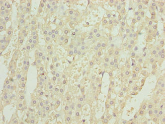 Immunohistochemistry of paraffin-embedded human adrenal gland tissue using CSB-PA823902LA01HU at dilution of 1:100 Immunohistochemistry of paraffin-embedded human adrenal gland tissue using CSB-PA823902LA01HU at dilution of 1:100