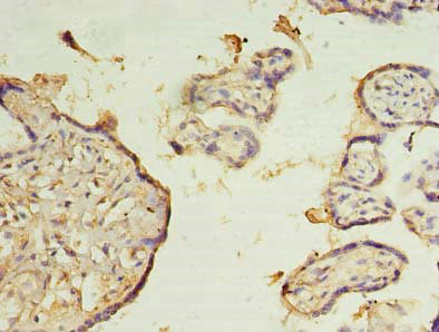 Immunohistochemistry of paraffin-embedded human placenta tissue using CSB-PA836202LA01HU at dilution of 1:100 Immunohistochemistry of paraffin-embedded human placenta tissue using CSB-PA836202LA01HU at dilution of 1:100