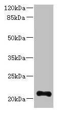 Western blot All lanes: TTC9C antibody at 12microg/ml + THP-1 whole cell lysate Secondary Goat polyclonal to rabbit IgG at 1/10000 dilution Predicted band size: 21, 25 kDa Observed band size: 21 kDa