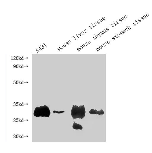 Western Blot Positive WB detected in: A431 whole cell lysate, Mouse liver tissue, Mouse thymus tissue, Mouse stomach tissue All lanes: RTP4 antibody at 1:1000 Secondary Goat polyclonal to rabbit IgG at 1/50000 dilution Predicted band size: 28 kDa Observed band size: 28 kDa