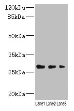 Western blot All lanes: LRRC57 antibody at 4microg/ml Lane 1: Mouse liver tissue Lane 2: Mouse kidney tissue Lane 3: Mouse lung tissue Secondary Goat polyclonal to rabbit IgG at 1/10000 dilution Predicted band size: 27 kDa Observed band size: 27 kDa Western blot All lanes: LRRC57 antibody at 4microg/ml Lane 1: Mouse liver tissue Lane 2: Mouse kidney tissue Lane 3: Mouse lung tissue Secondary Goat polyclonal to rabbit IgG at 1/10000 dilution Predicted band size: 27 kDa Observed band size: 27 kDa