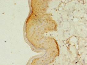 Immunohistochemistry of paraffin-embedded human skin tissue using CSB-PA850254LA01HU at dilution of 1:100