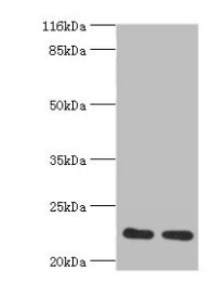 Western blot All lanes: RERG antibody at 2ug/ml Lane 1: Mouse thymus tissue Lane 2: Rat lung tissue Secondary Goat polyclonal to rabbit at 1/10000 dilution Predicted band size: 23, 21 kDa Observed band size: 23 kDa Western blot All lanes: RERG antibody at 2ug/ml Lane 1: Mouse thymus tissue Lane 2: Rat lung tissue Secondary Goat polyclonal to rabbit at 1/10000 dilution Predicted band size: 23, 21 kDa Observed band size: 23 kDa