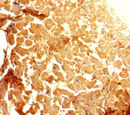 Immunohistochemistry of paraffin-embedded human heart tissue using CSB-PA850268HA01HU at dilution of 1:100