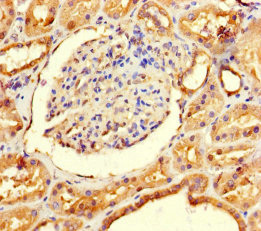 Immunohistochemistry of paraffin-embedded human kidney tissue using CSB-PA850268HA01HU at dilution of 1:100