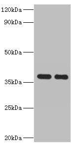 Western blot All lanes: GALM antibody at 2microg/ml Lane 1: Mouse kidney tissue Lane 2: Rat adrenal gland tissue Secondary Goat polyclonal to rabbit IgG at 1/10000 dilution Predicted band size: 38 kDa Observed band size: 38 kDa Western blot All lanes: GALM antibody at 2microg/ml Lane 1: Mouse kidney tissue Lane 2: Rat adrenal gland tissue Secondary Goat polyclonal to rabbit IgG at 1/10000 dilution Predicted band size: 38 kDa Observed band size: 38 kDa