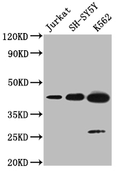Western blot All lanes: NSUN4 antibody at 0.6ug/ml + 293T whole cell lysate Secondary Goat polyclonal to rabbit at 1/10000 dilution Predicted band size: 44, 17, 22, 38 kDa Observed band size: 44 kDa Western blot All lanes: NSUN4 antibody at 0.6ug/ml + 293T whole cell lysate Secondary Goat polyclonal to rabbit at 1/10000 dilution Predicted band size: 44, 17, 22, 38 kDa Observed band size: 44 kDa