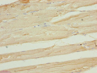 Immunohistochemistry of paraffin-embedded human skeletal muscle tissue using CSB-PA850277LA01HU at dilution of 1:100