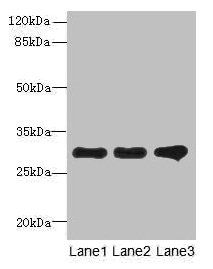 Western blot All lanes: RMDN1 antibody at 0.6microg/ml Lane 1: K562 whole cell lysate Lane 2: HepG2 whole cell lysate Lane 3: MCF-7 whole cell lysate Secondary Goat polyclonal to rabbit IgG at 1/10000 dilution Predicted band size: 36, 33, 31 kDa Observed band size: 31 kDa Western blot All lanes: RMDN1 antibody at 0.6microg/ml Lane 1: K562 whole cell lysate Lane 2: HepG2 whole cell lysate Lane 3: MCF-7 whole cell lysate Secondary Goat polyclonal to rabbit IgG at 1/10000 dilution Predicted band size: 36, 33, 31 kDa Observed band size: 31 kDa