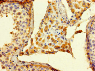 Immunohistochemistry of paraffin-embedded human testis tissue using CSB-PA850291LA01HU at dilution of 1:100 Immunohistochemistry of paraffin-embedded human testis tissue using CSB-PA850291LA01HU at dilution of 1:100