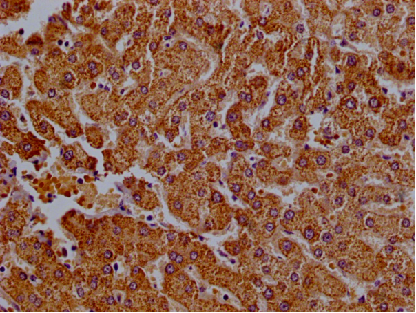 Immunohistochemistry of paraffin-embedded human liver tissue using CSB-PA850772LA01HU at dilution of 1:100