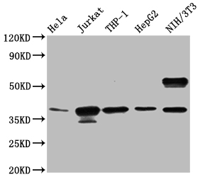 Western Blot Positive WB detected in: Hela whole cell lysate, Jurkat whole cell lysate, THP-1 whole cell lysate, HepG2 whole cell lysate, NIH/3T3 whole cell lysate All lanes: CLYBL antibody at 1:1000 Secondary Goat polyclonal to rabbit IgG at 1/50000 dilution Predicted band size: 38, 34 KDa Observed band size: 38 KDa Exposure time : 5min Western Blot Positive WB detected in: Hela whole cell lysate, Jurkat whole cell lysate, THP-1 whole cell lysate, HepG2 whole cell lysate, NIH/3T3 whole cell lysate All lanes: CLYBL antibody at 1:1000 Secondary Goat polyclonal to rabbit IgG at 1/50000 dilution Predicted band size: 38, 34 KDa Observed band size: 38 KDa Exposure time : 5min