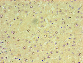 Immunohistochemistry of paraffin-embedded human liver tissue using CSB-PA850802HA01HU at dilution of 1:100 Immunohistochemistry of paraffin-embedded human liver tissue using CSB-PA850802HA01HU at dilution of 1:100