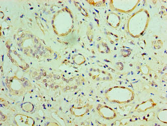 Immunohistochemistry of paraffin-embedded human adrenal gland tissue using CSB-PA850802HA01HU at dilution of 1:100