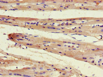 Immunohistochemistry of paraffin-embedded human heart tissue using CSB-PA854028LA01HU at dilution of 1:100
