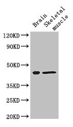 Western Blot Positive WB detected in: Mouse brain tissue, Mouse skeletal muscle tissue All lanes: FAM43A antibody at 3ug/ml Secondary Goat polyclonal to rabbit IgG at 1/50000 dilution Predicted band size: 46 kDa Observed band size: 46 kDa Western Blot Positive WB detected in: Mouse brain tissue, Mouse skeletal muscle tissue All lanes: FAM43A antibody at 3ug/ml Secondary Goat polyclonal to rabbit IgG at 1/50000 dilution Predicted band size: 46 kDa Observed band size: 46 kDa