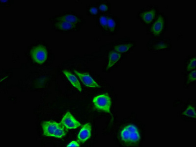 Immunofluorescent analysis of PC-3 cells using CSB-PA856402LA01HU at dilution of 1:100 and Alexa Fluor 488-congugated AffiniPure Goat Anti-Rabbit IgG(H+L) Immunofluorescent analysis of PC-3 cells using CSB-PA856402LA01HU at dilution of 1:100 and Alexa Fluor 488-congugated AffiniPure Goat Anti-Rabbit IgG(H+L)